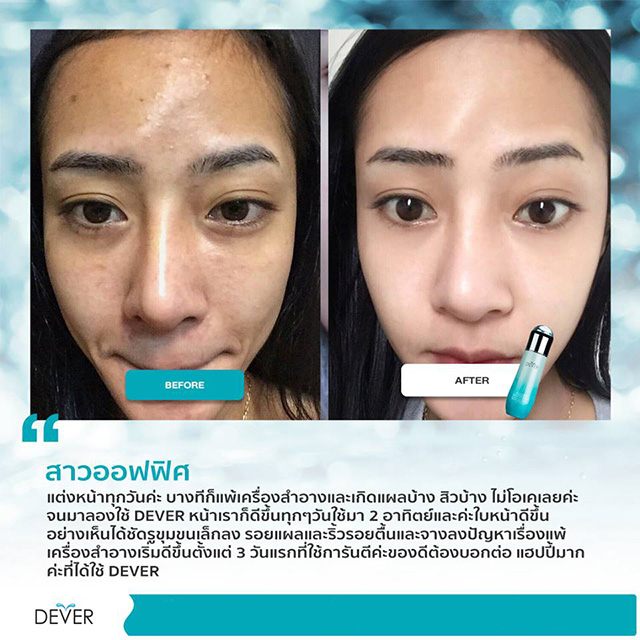 Dever Aqua Serum Fresh Plankton ดีเวอร์ อควา เซรั่ม