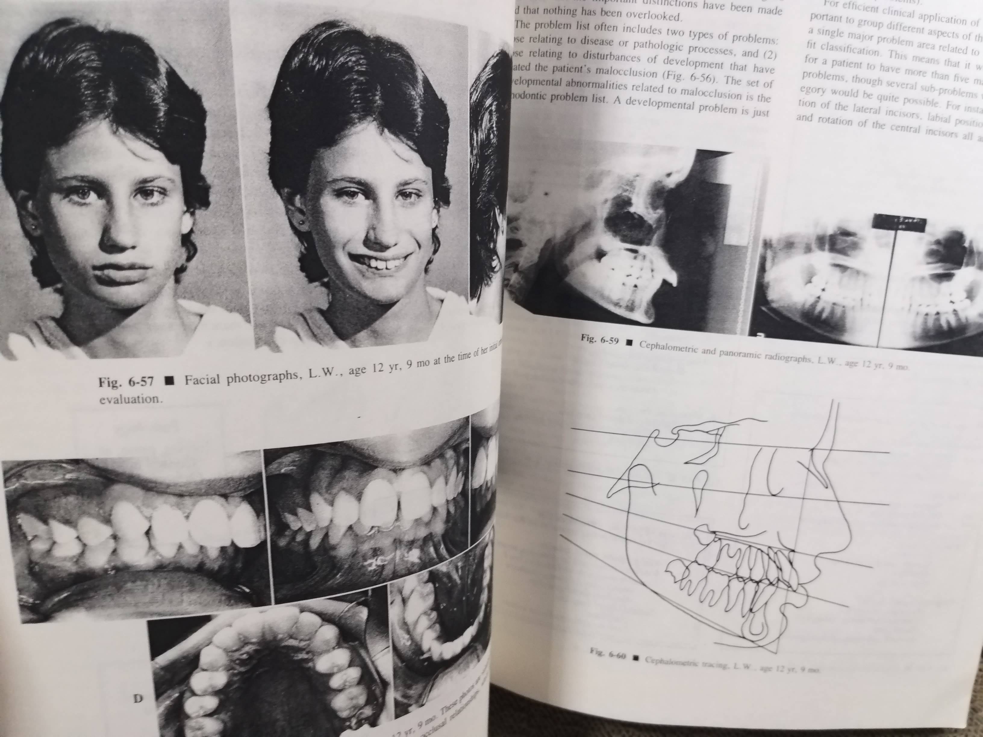 ตำรา Contemporary Orthodontics (2nd)