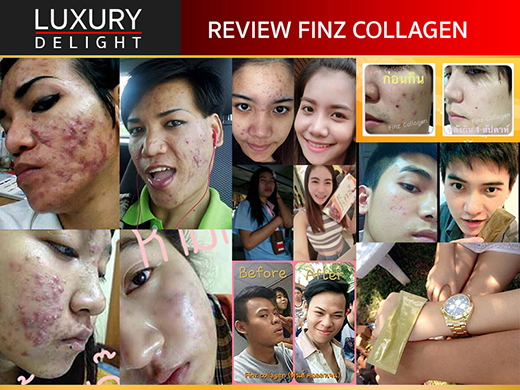 Finz Collagen ฟินส์ คอลลาเจน