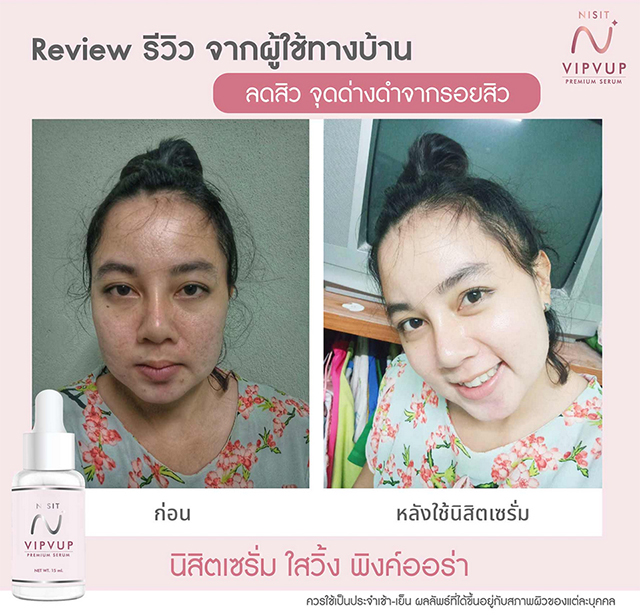 นิสิตเซรั่ม Nisit Serum นิสิต วิบวับ เซรั่ม