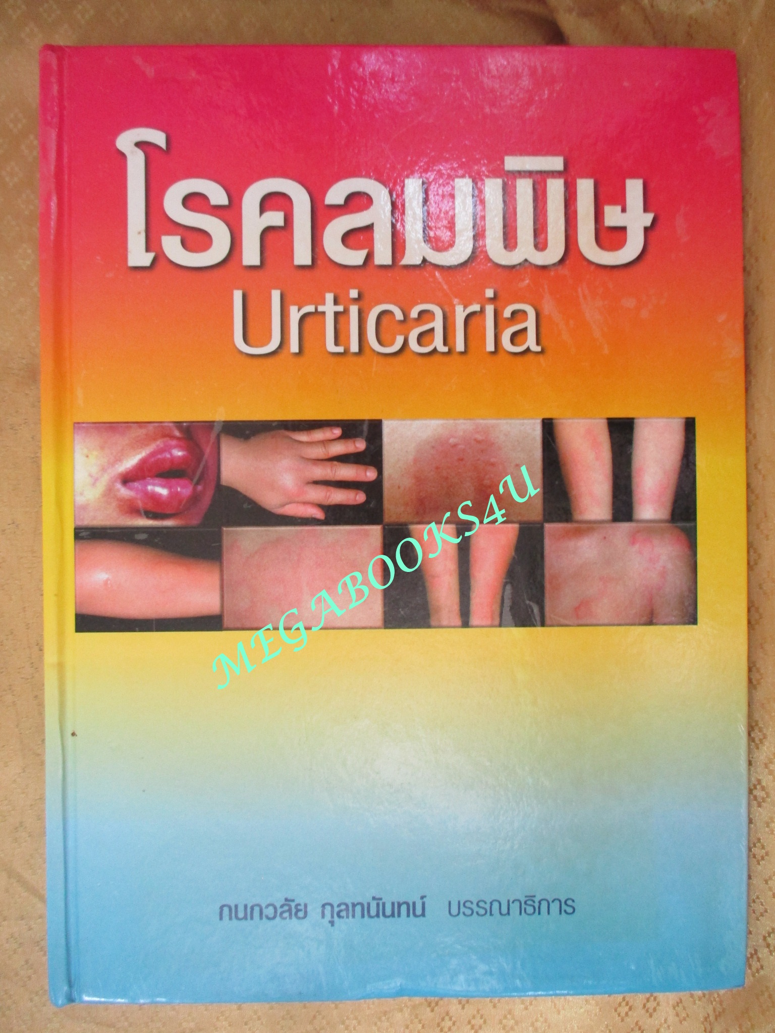 หนังสือ โรคลมพิษ Urticaria / ผู้นิพนธ์ กนกวลัย กุลทนันทน์