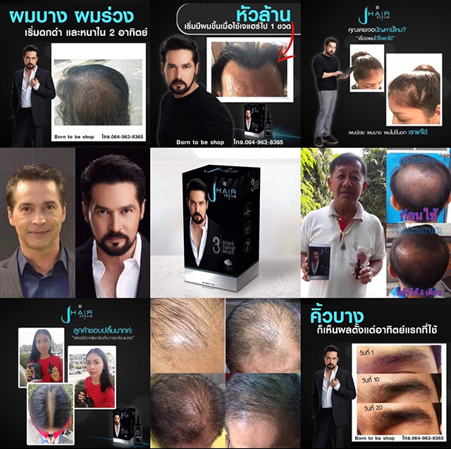 JHair Serum เจ แฮร์ เซรั่ม ผลิตภัณฑ์บำรุงเส้นผม