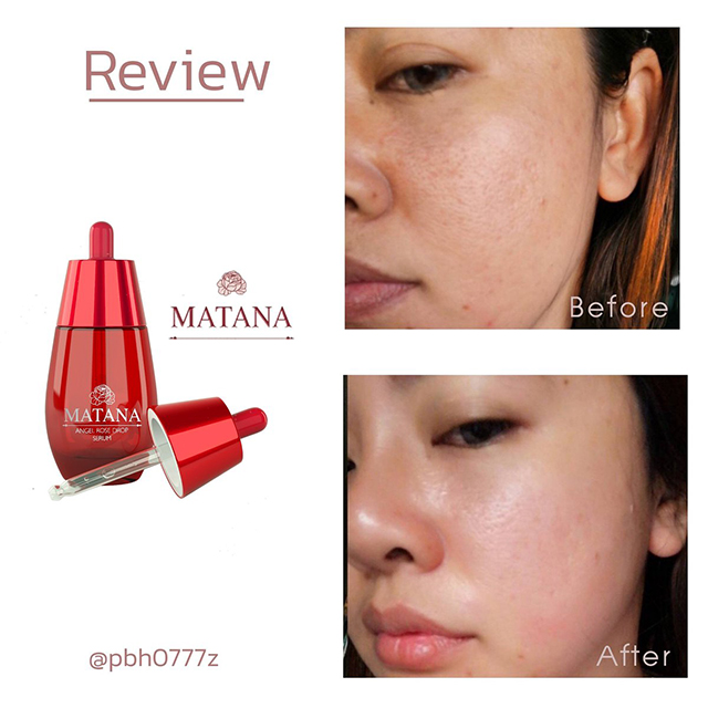 Matana มัทนา เซรั่ม ดอกกุหลาบ ราคาถูก ฟรีของแถมทุกรายการ ผลิตภัณฑ์ลดเลือนริ้วรอย