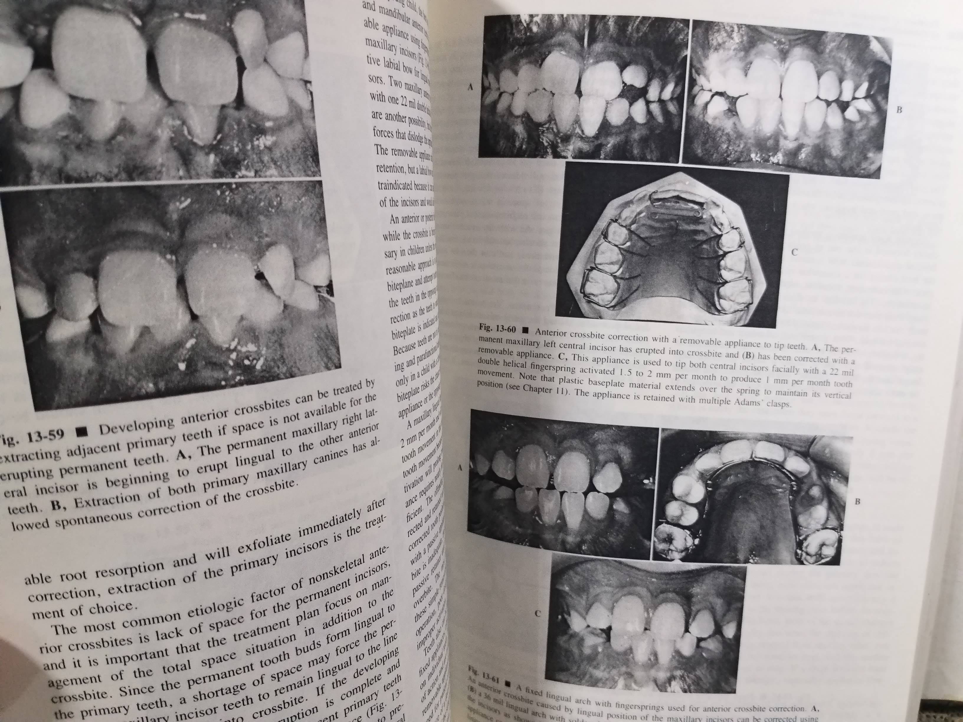 ตำรา Contemporary Orthodontics (2nd)