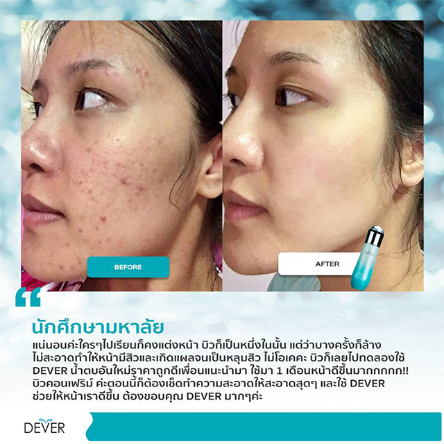 Dever Aqua Serum Fresh Plankton ดีเวอร์ อควา เซรั่ม