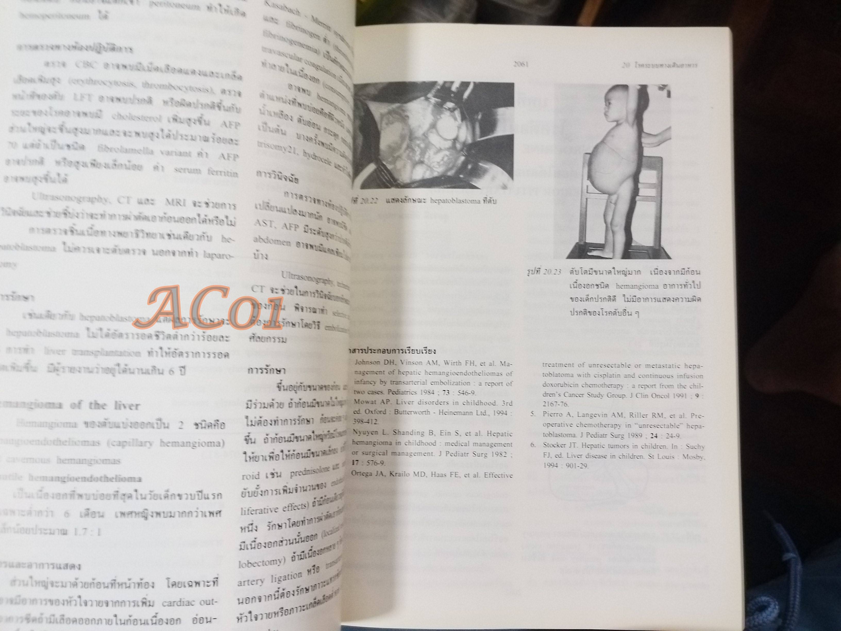 กุมารเวชศาสตร์ PEDIATRICS เล่ม 1 เล่ม2 เล่ม3 / มนตรี ตู้จินดา วินัย สุวัตถี อรุณ วงษ์จิราษฎร์ / ตำหนิ มี ขีดเส้นใต้และไฮไลท์ บางหน้า