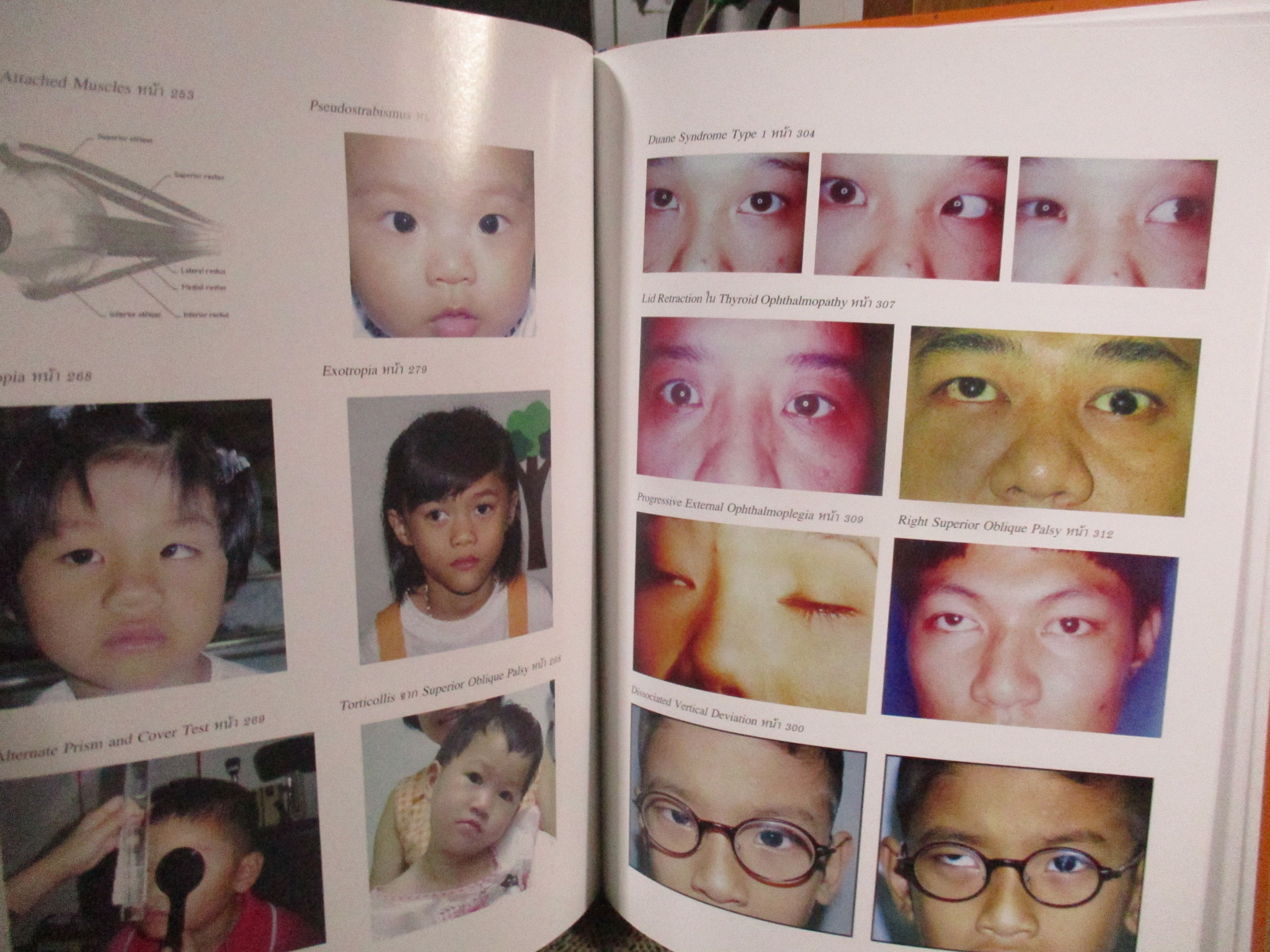 หนังสือ ตำราจักษุวิทยาเด็กและตาเข / ชมรมจักษุวิทยาเด็กและตาเข / น.พ. ศักดิ์ชัย วงศกิตติรักษ์ (F/B)