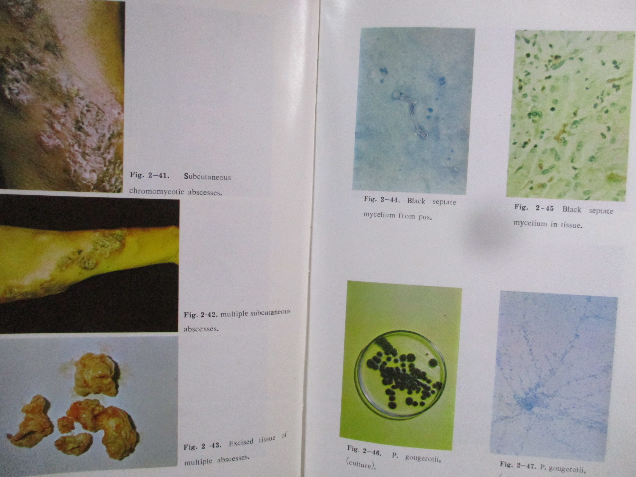 หนังสือ ภาพสีโรคผิวหนังในประเทศไทย / COLOR ATLAS OF SKIN DISEASES / สถาบันโรคผิวหนัง /หน้าปกดูเก่าหน่อย เกิดจากปกพลาสติกเก่า (F/B)