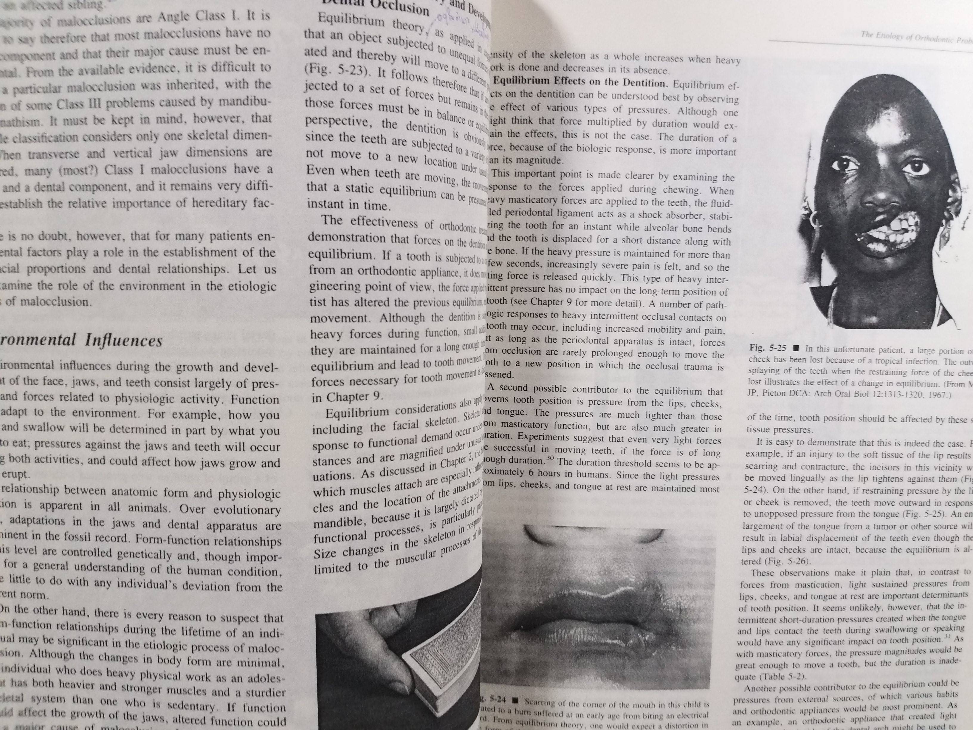 ตำรา Contemporary Orthodontics (2nd)