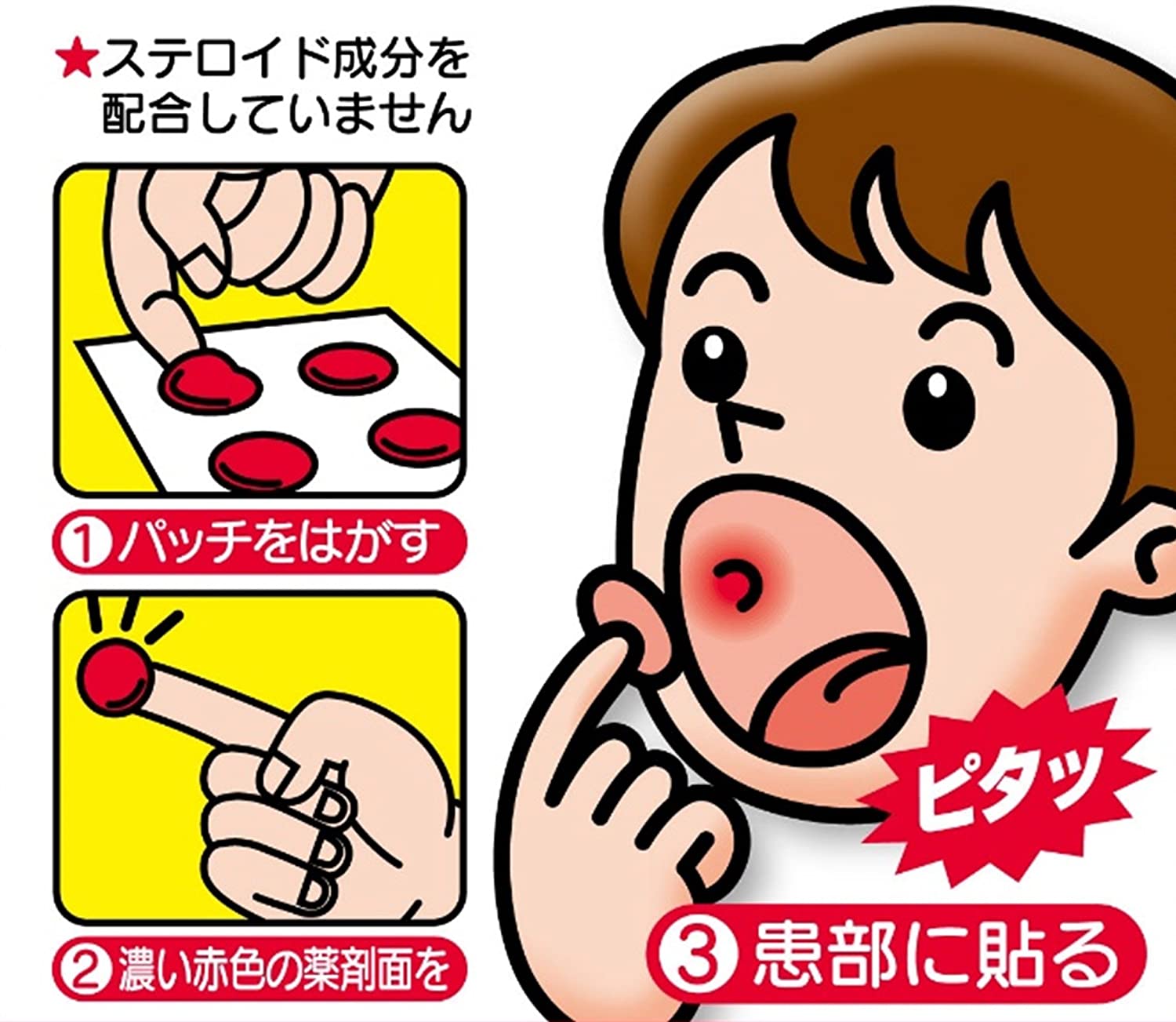 พร้อมส่ง แผ่นแปะแก้ร้อนใน Taisho Quick Care Patch แผ่นแปะร้อนในญี่ปุ่น แผลร้อนใน แผลในช่องปาก กล่องขาว สูตรปกติ