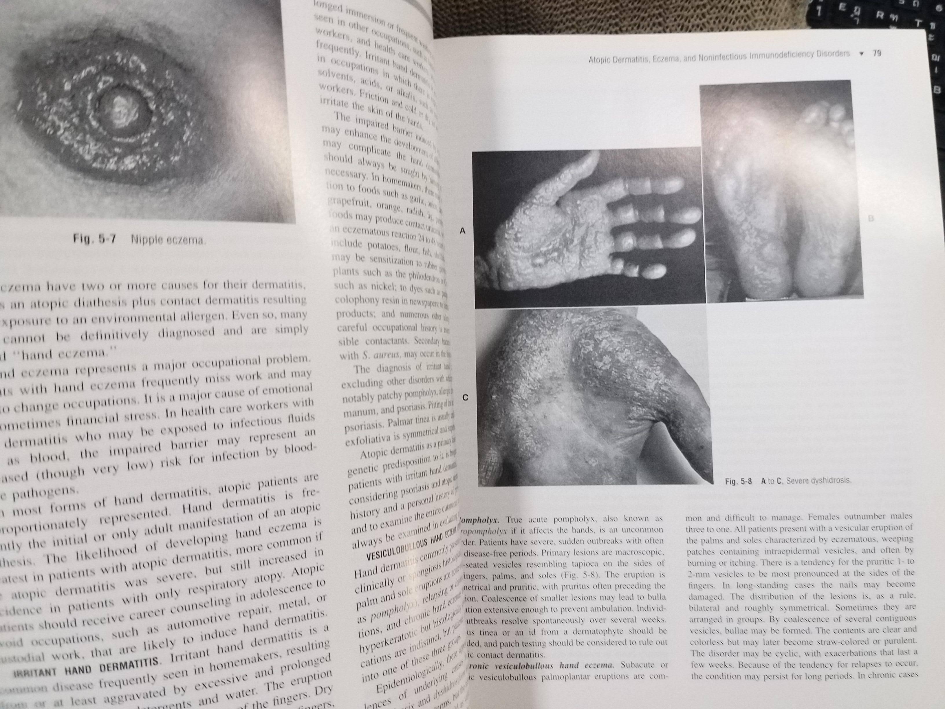 หนังสือปกแข็ง โรคผิวหนัง Andrews' Diseases of the Skin: Clinical Dermatology 9th Edition