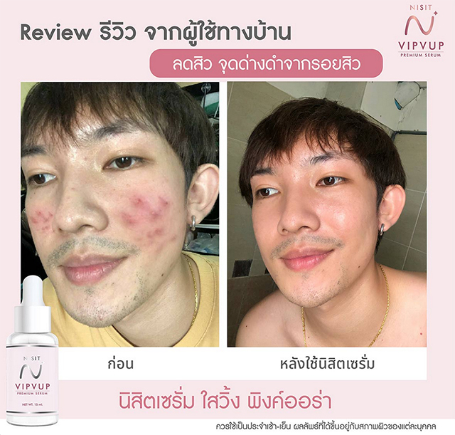 นิสิตเซรั่ม Nisit Serum นิสิต วิบวับ เซรั่ม