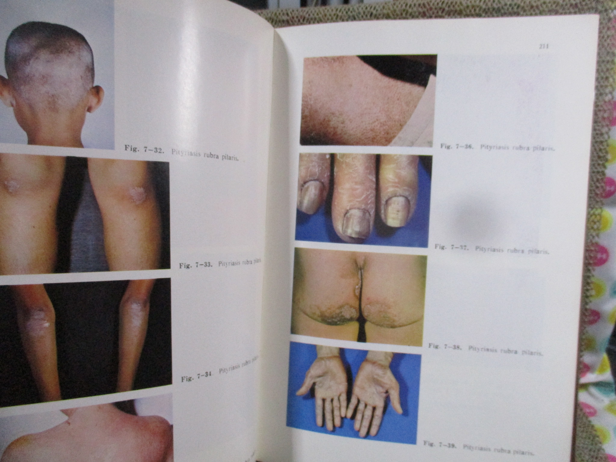 หนังสือ ภาพสีโรคผิวหนังในประเทศไทย / COLOR ATLAS OF SKIN DISEASES / สถาบันโรคผิวหนัง /หน้าปกดูเก่าหน่อย เกิดจากปกพลาสติกเก่า (F/B)