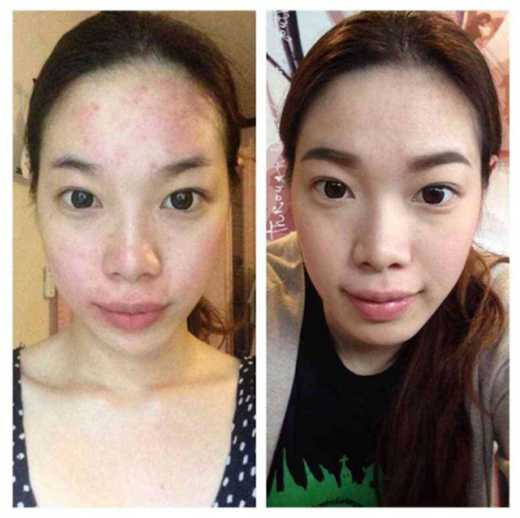 น้ำแร่ไฮโดร Hydro Cellusion SOL