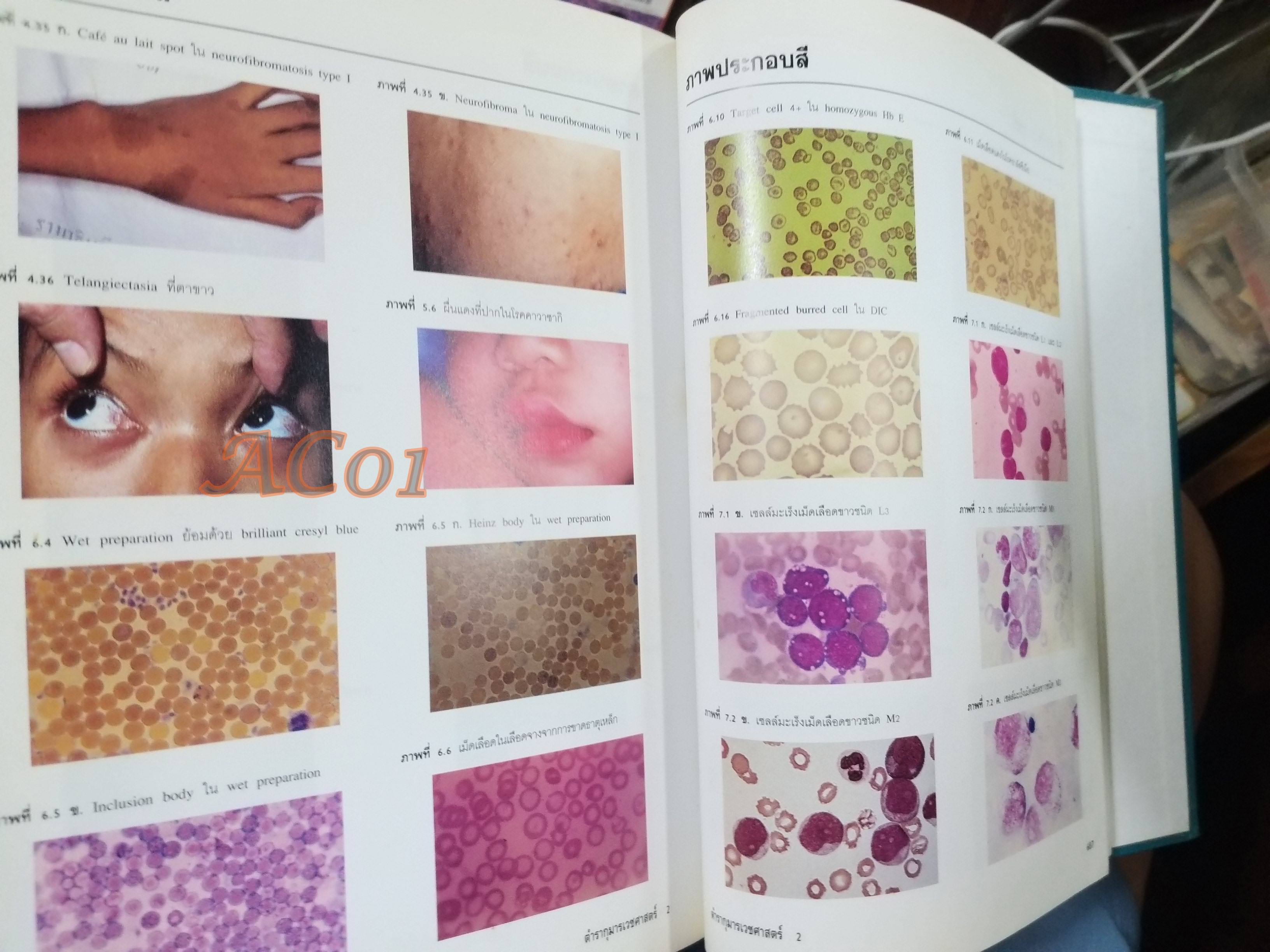 ตำรากุมารเวชศาสตร์ ฉบับเรียบเรียงใหม่ เล่ม 2 / วันดี วราวิทย์ ประพุทธ ศิริปุณย์ สุรางค์ เจียมจรรย / ตำหนิ มี ขีดเส้นใต้และไฮไลท์ บางหน้า