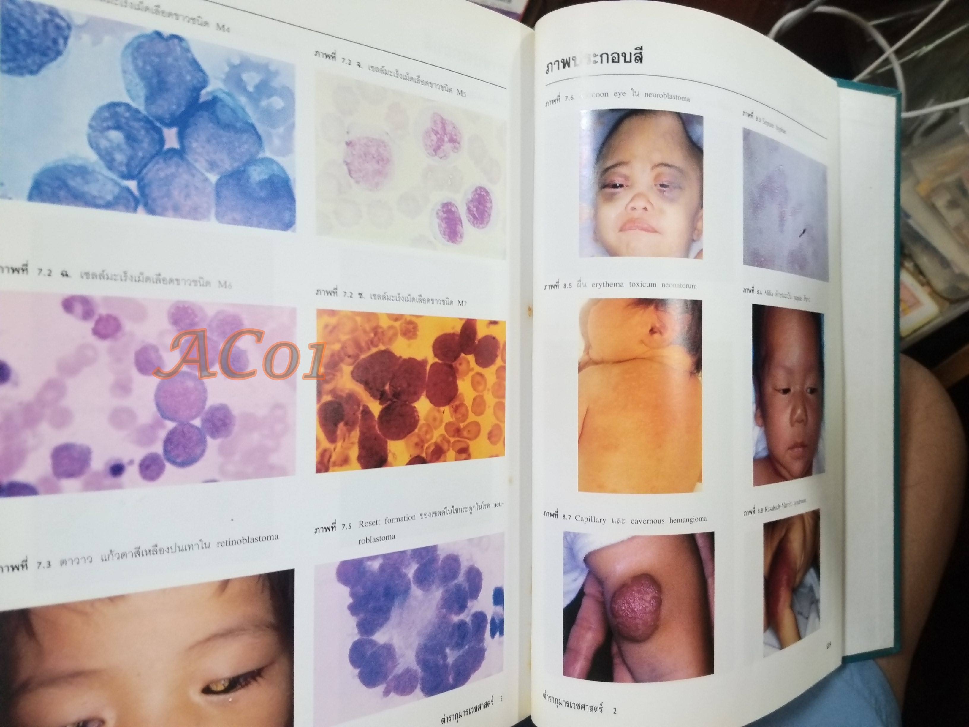 ตำรากุมารเวชศาสตร์ ฉบับเรียบเรียงใหม่ เล่ม 2 / วันดี วราวิทย์ ประพุทธ ศิริปุณย์ สุรางค์ เจียมจรรย / ตำหนิ มี ขีดเส้นใต้และไฮไลท์ บางหน้า