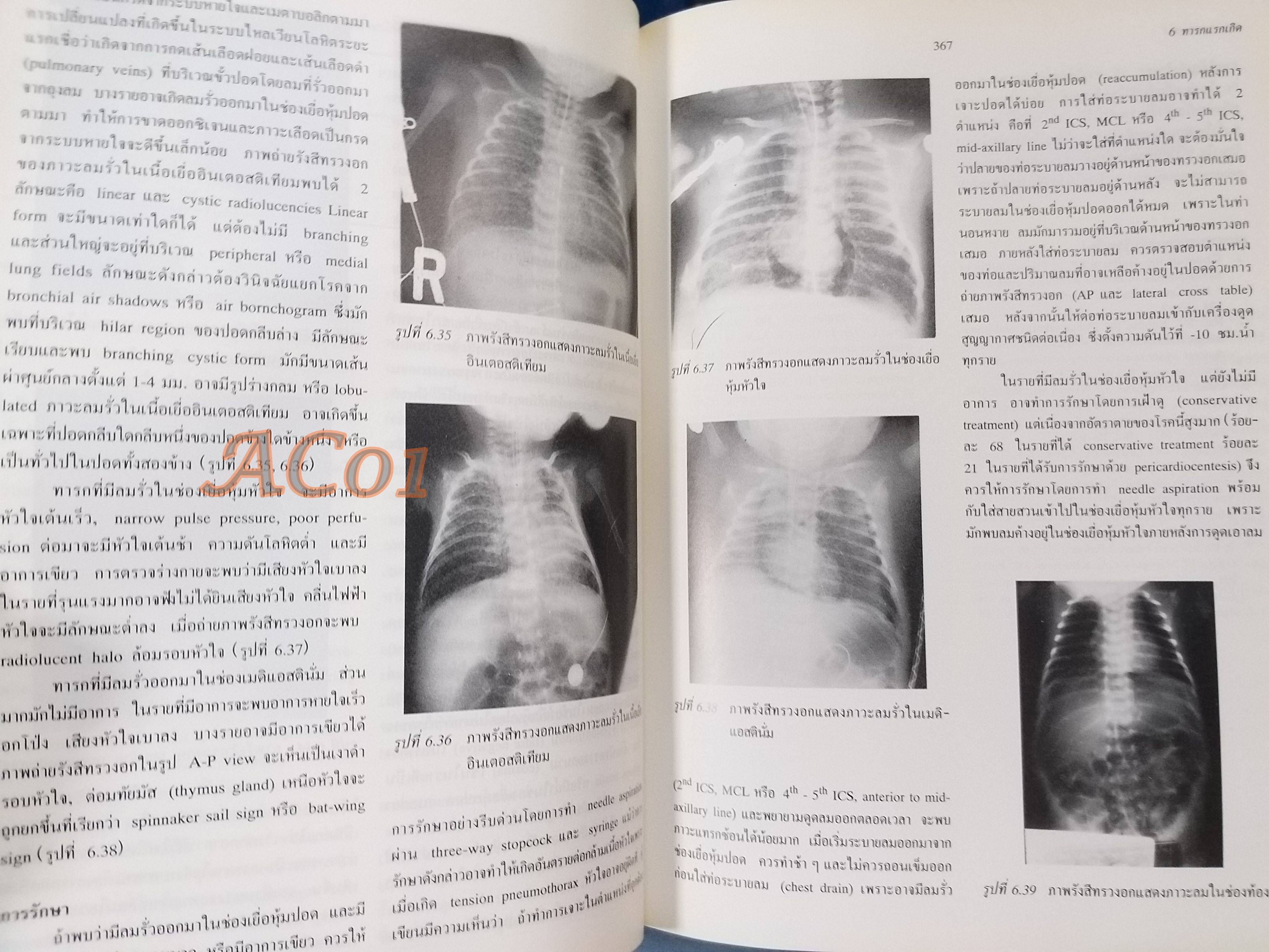 กุมารเวชศาสตร์ PEDIATRICS เล่ม 1 เล่ม2 เล่ม3 / มนตรี ตู้จินดา วินัย สุวัตถี อรุณ วงษ์จิราษฎร์ / ตำหนิ มี ขีดเส้นใต้และไฮไลท์ บางหน้า