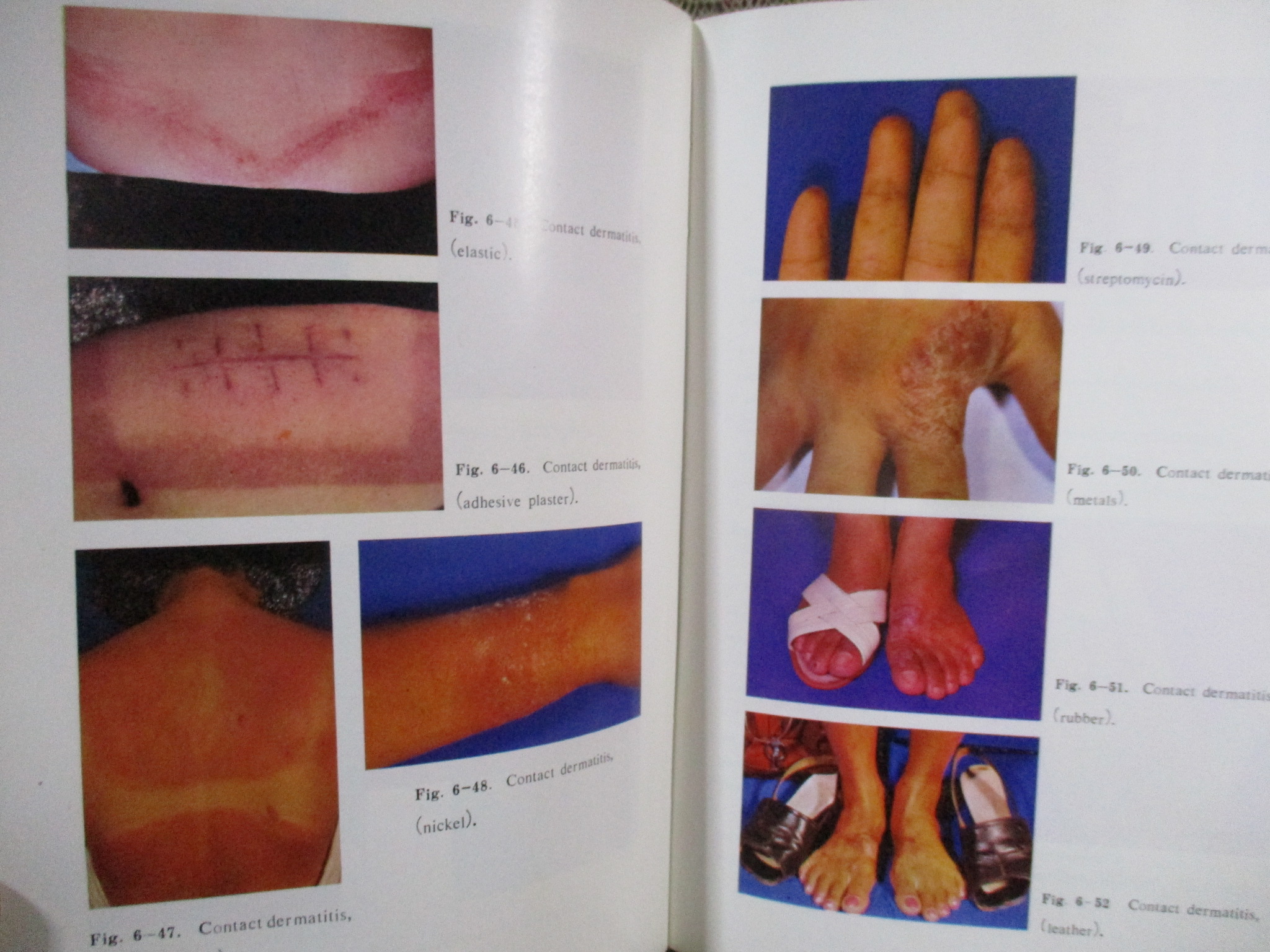 หนังสือ ภาพสีโรคผิวหนังในประเทศไทย / COLOR ATLAS OF SKIN DISEASES / สถาบันโรคผิวหนัง /หน้าปกดูเก่าหน่อย เกิดจากปกพลาสติกเก่า (F/B)