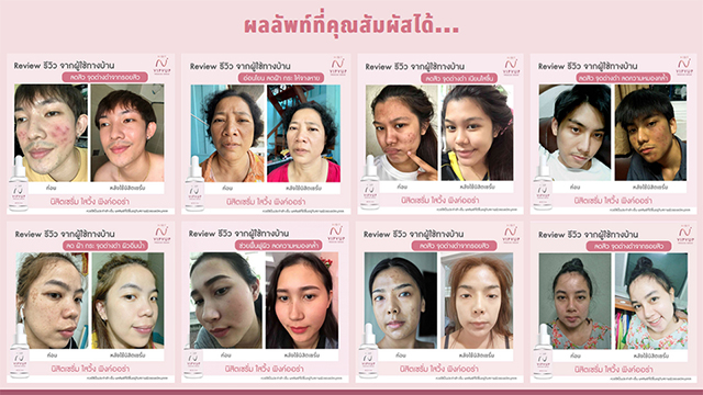 นิสิตเซรั่ม Nisit Serum นิสิต วิบวับ เซรั่ม