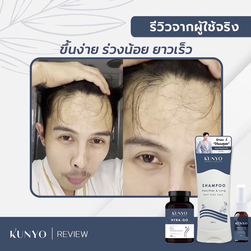 สเปย์คุณโย KUNYO Hair Spray บำรุงรากผม ฟรีของแถมทุกรายการ ช่วยลดปัญหารังแค กระตุ่นผมใหม่ ผมหนา ลดอาการคันหนังศีรษะ