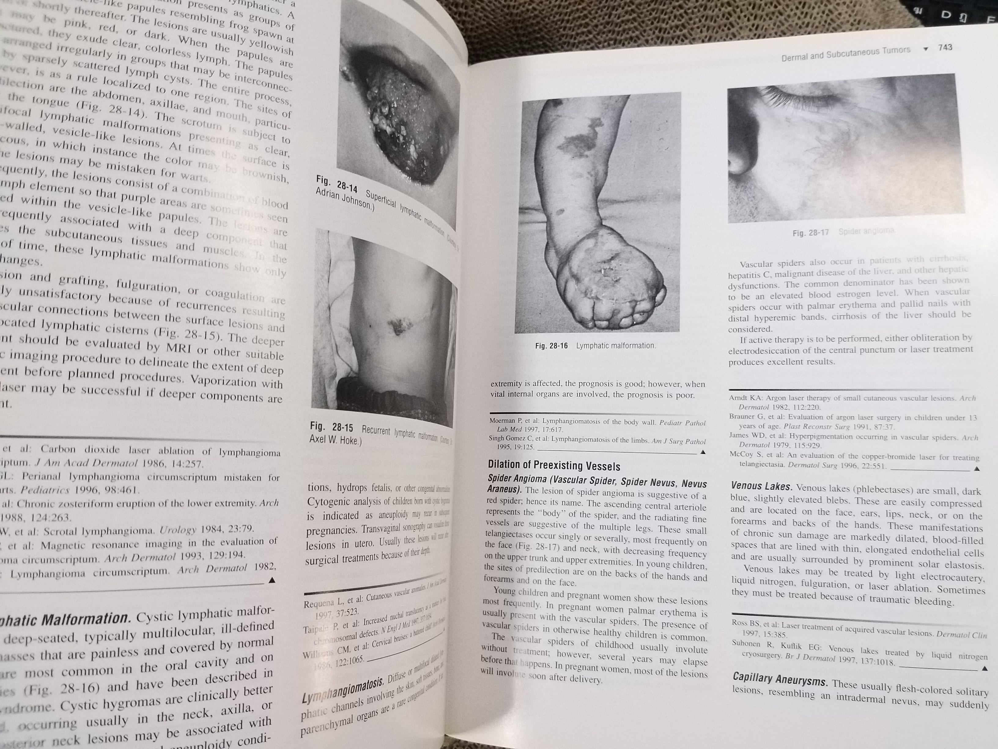 หนังสือปกแข็ง โรคผิวหนัง Andrews' Diseases of the Skin: Clinical Dermatology 9th Edition