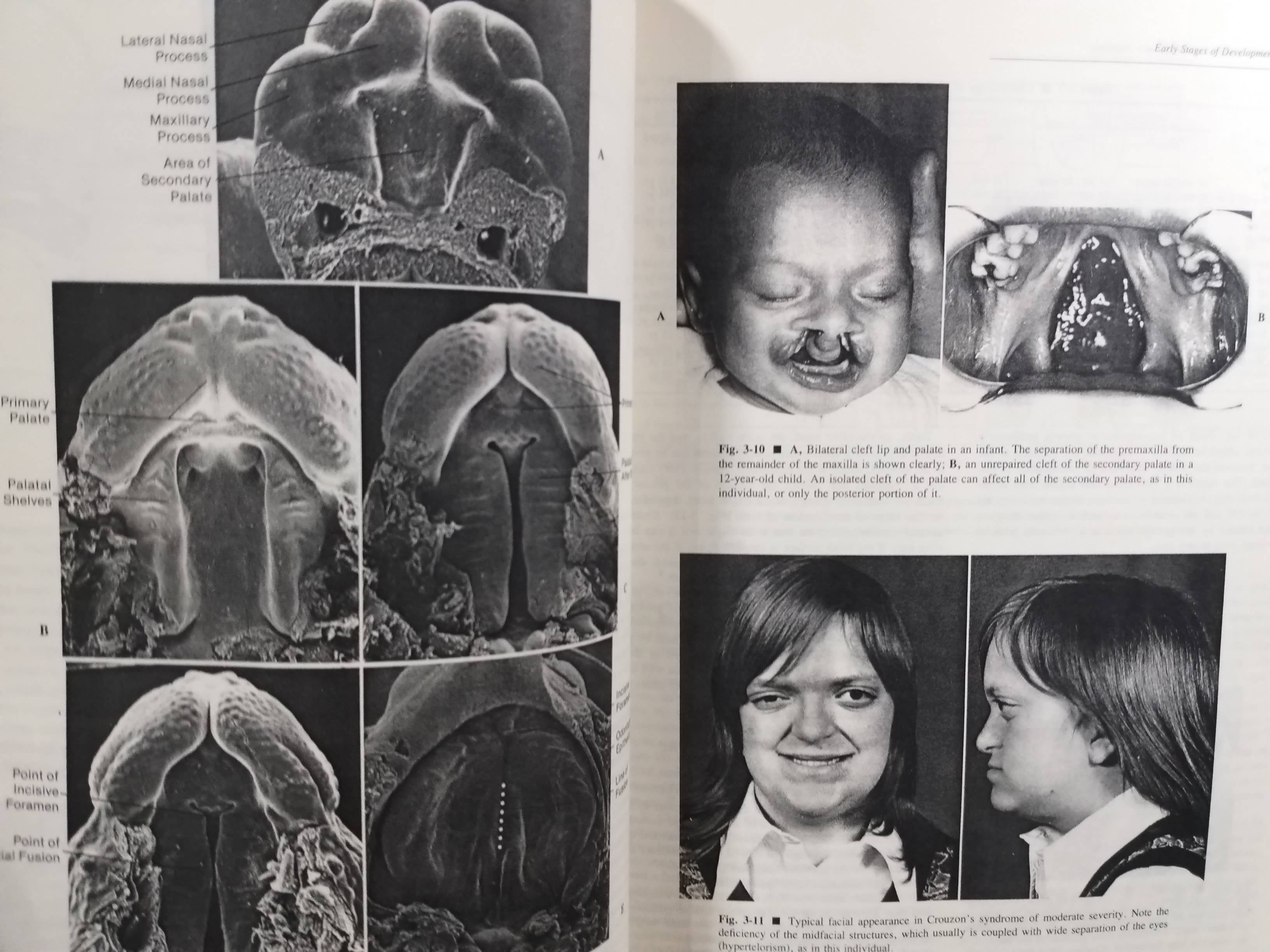 ตำรา Contemporary Orthodontics (2nd)
