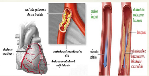 ABO X เอบีโอ-เอ็กซ์ บำรุงเลือด PK2 ABO-X