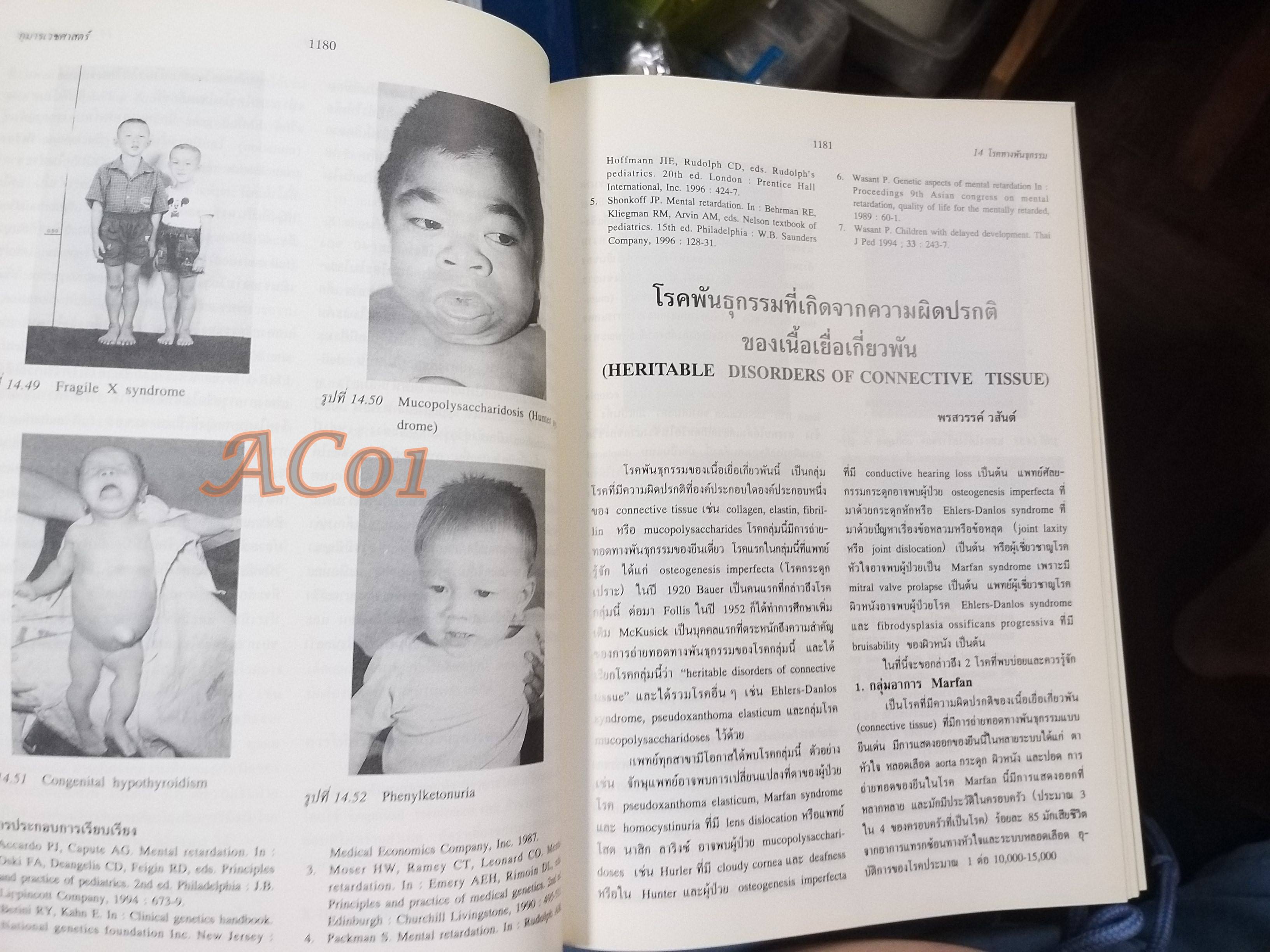 กุมารเวชศาสตร์ PEDIATRICS เล่ม 1 เล่ม2 เล่ม3 / มนตรี ตู้จินดา วินัย สุวัตถี อรุณ วงษ์จิราษฎร์ / ตำหนิ มี ขีดเส้นใต้และไฮไลท์ บางหน้า