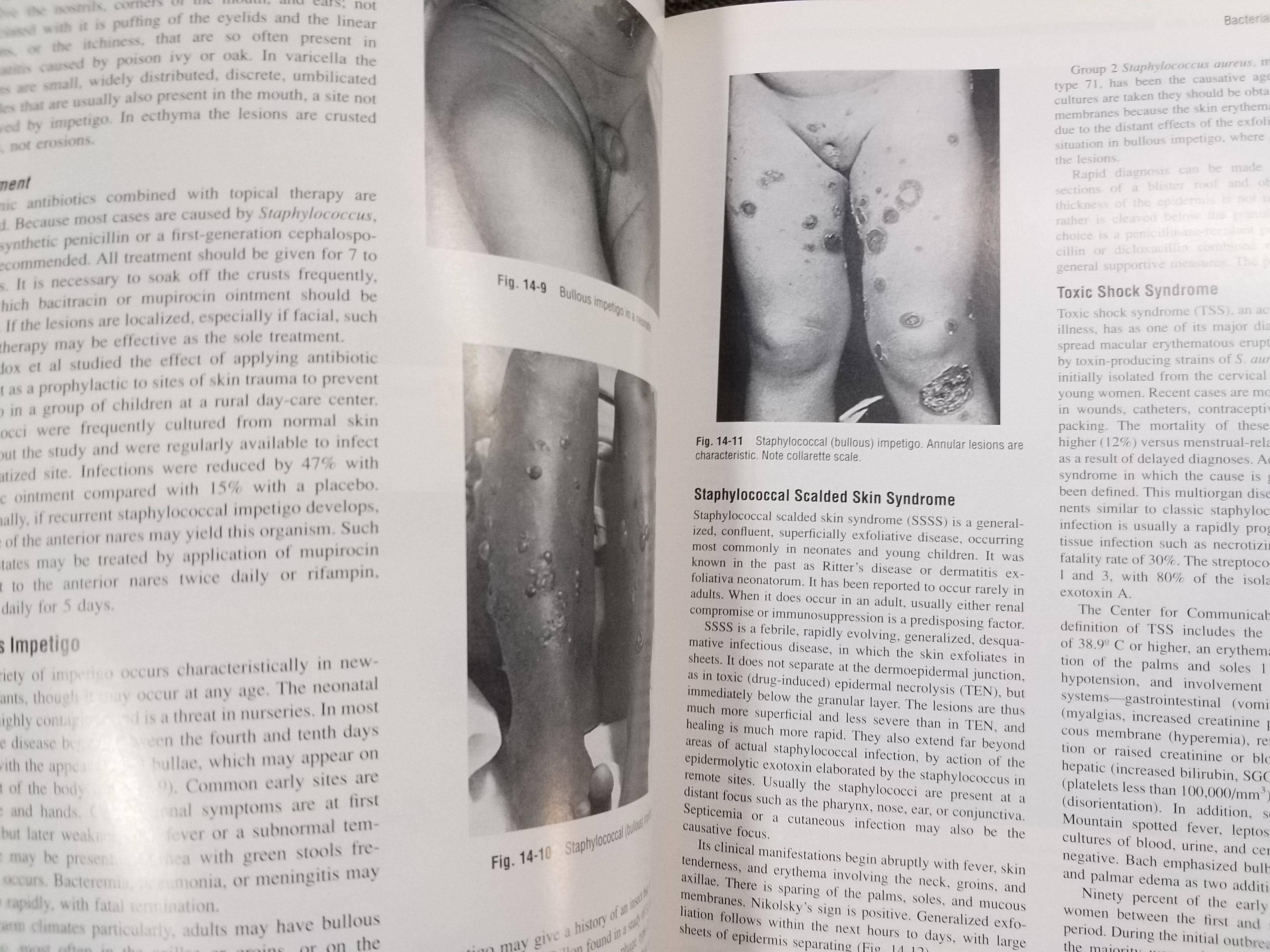 หนังสือปกแข็ง โรคผิวหนัง Andrews' Diseases of the Skin: Clinical Dermatology 9th Edition