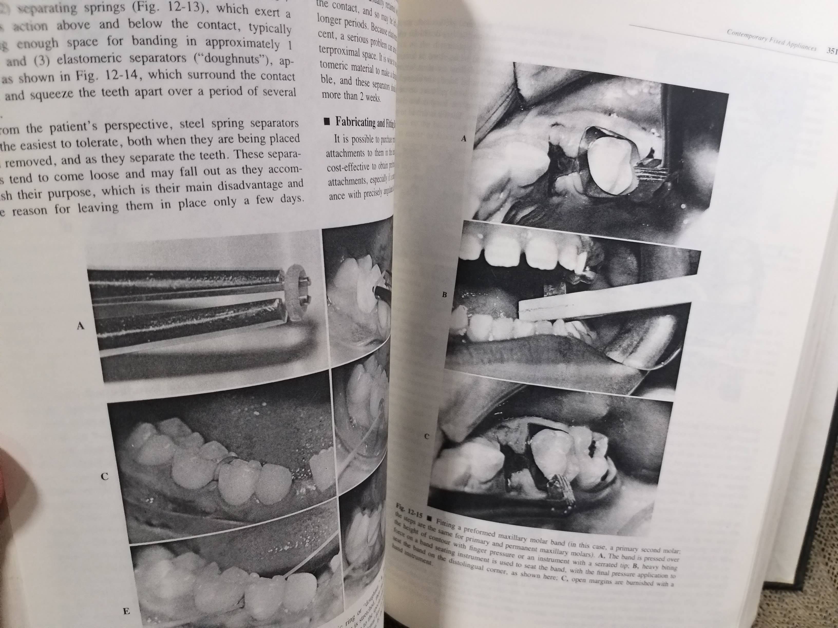 ตำรา Contemporary Orthodontics (2nd)