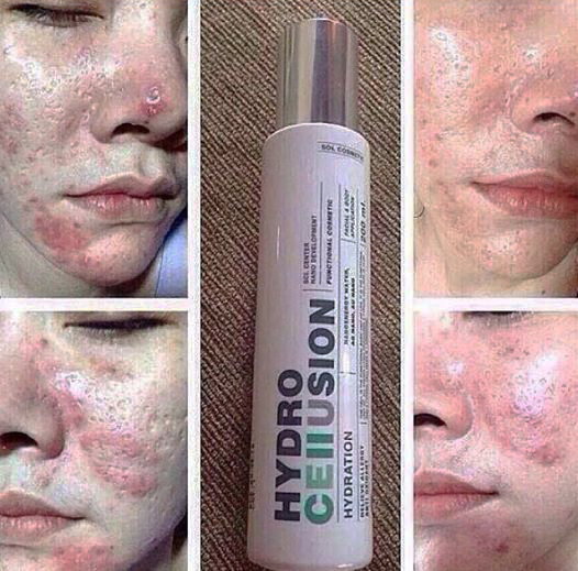 น้ำแร่ไฮโดร Hydro Cellusion SOL