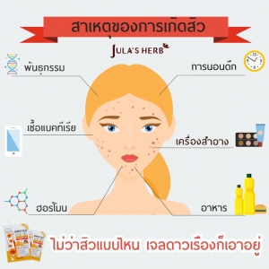 สาเหตุที่ทำให้เกิดสิวและการป้องกันไม่ให้เกิดสิว