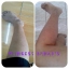 เซตแก้ขาลายท้องลาย Pricess Super White Body Set