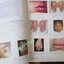 หนังสือ โรคลมพิษ Urticaria / ผู้นิพนธ์ กนกวลัย กุลทนันทน์
